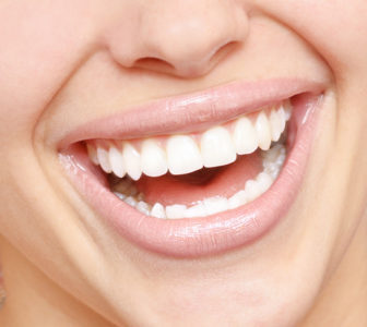 close up of bright smile with healthy teeth